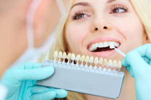 Teeth Bleaching